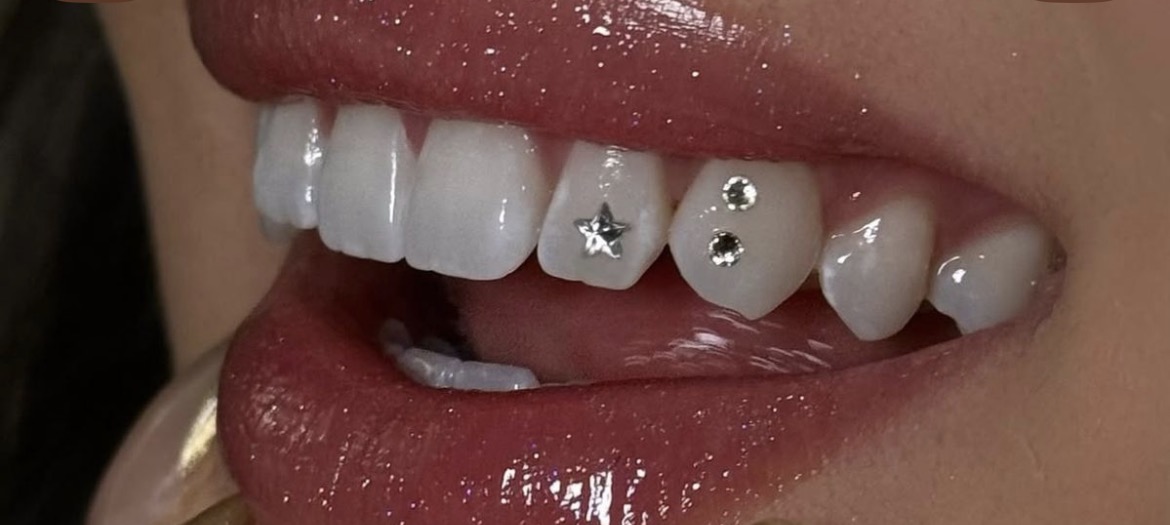 PERMATA GIGI / DIAMOND TEETH